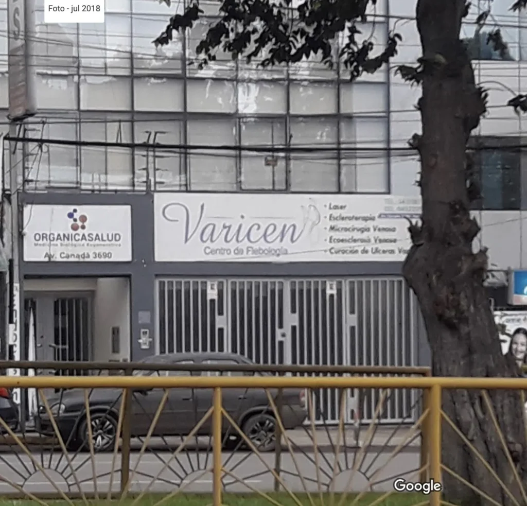 Varicen en San Luis, Lima